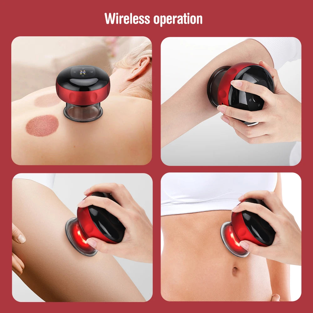 SmartCup™ Medical Electric Vacuum Cupping Therapy